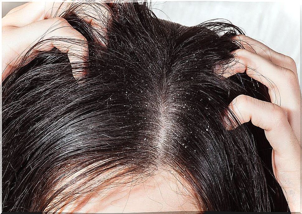 scalp-infection