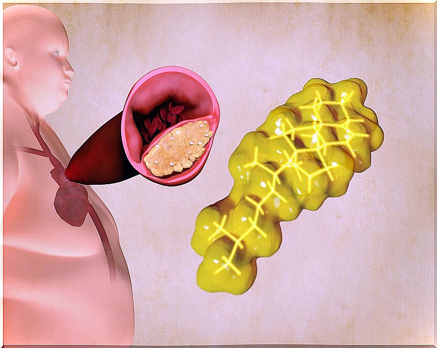 Types of lipids