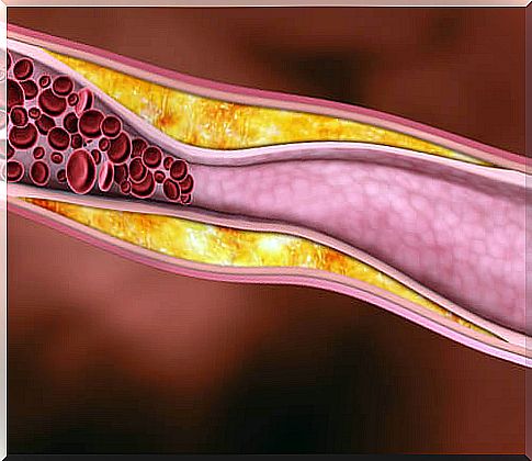 Cholesterol