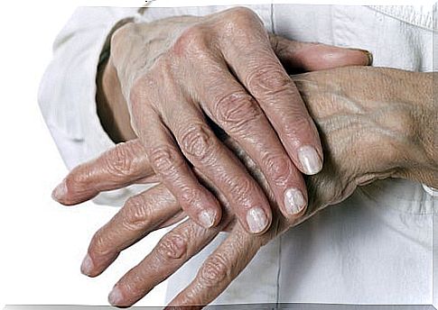 Natural remedies for cracked hands