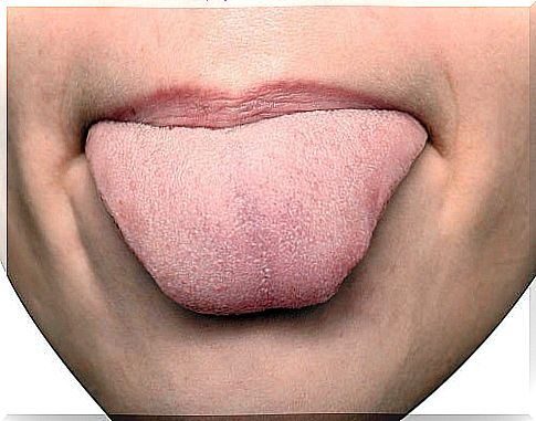 Marks on the tongue and their meaning